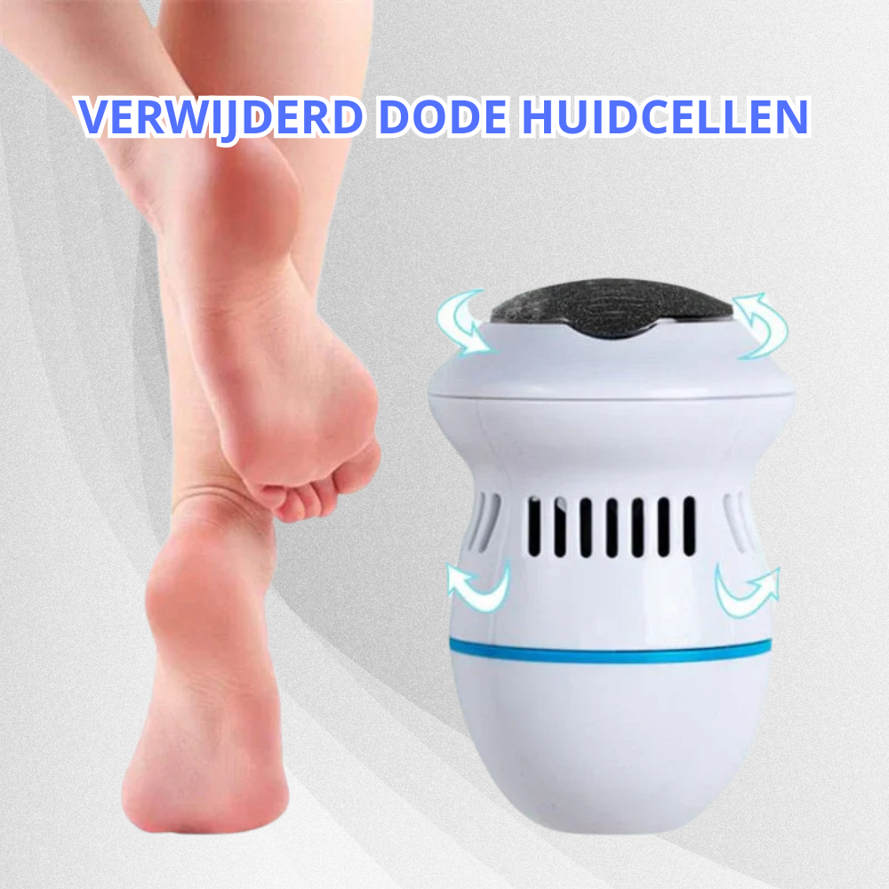 FootGlide Pro™ | Elektrische eeltverwijderaar